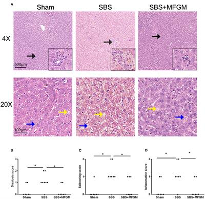 Milk Fat Globule Membrane Alleviates Short Bowel Syndrome-Associated Liver Injury in Rats Through Inhibiting Autophagy and NLRP3 Inflammasome Activation